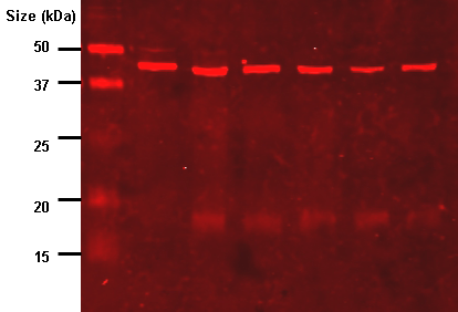 Anti-lipoic_acid_immunoblot.png